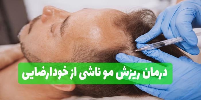 درمان ریزش مو ناشی از خودارضایی